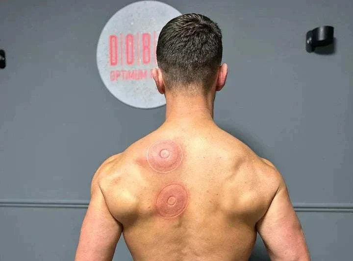 SmartCup dynamic cupping therapy device with red light and heat therapy features