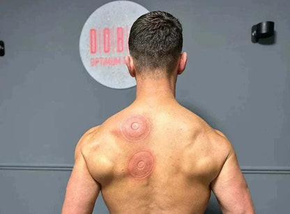 SmartCup dynamic cupping therapy device with red light and heat therapy features