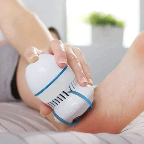 Vacuum callus remover device gently removing calluses from feet